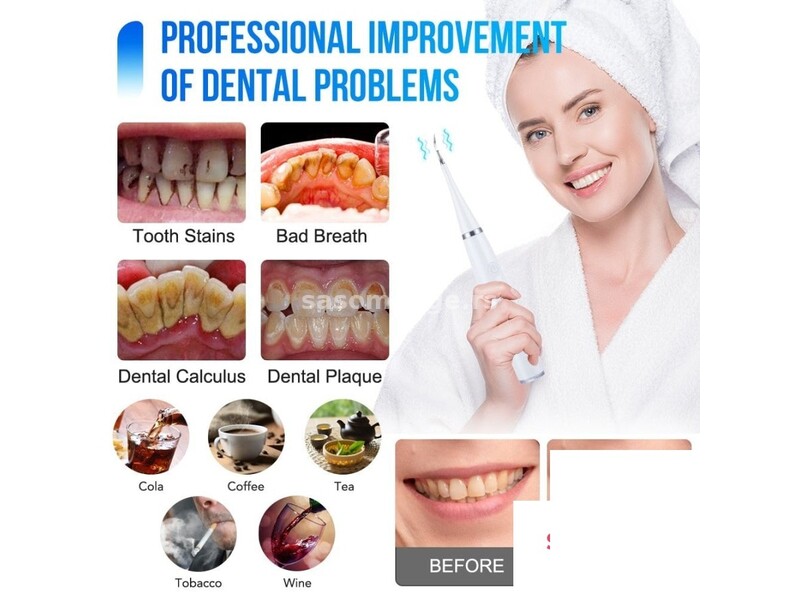 Aparat za uklanjanje zubnog kamenca Ciscenje zuba - Aparat za uklanjanje zubnog kamenca Ciscenje ...