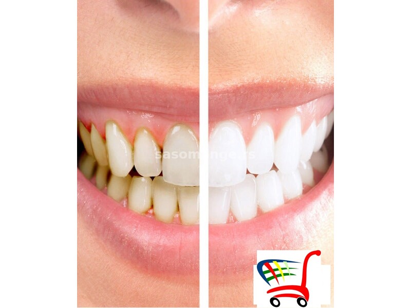 Dentalni Aparat Za Čišćenje Zubnog Kamenca - Dentalni Aparat Za Čišćenje Zubnog Kamenca