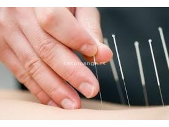 Akupunktura i Kvantna medicina – Leskovac