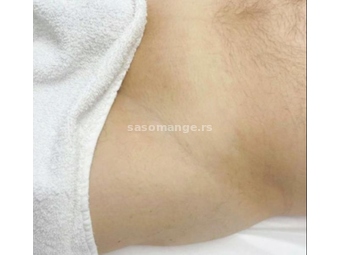 Muška intimna depilacija